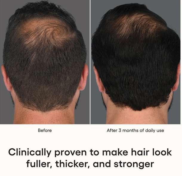 HAIR Serum