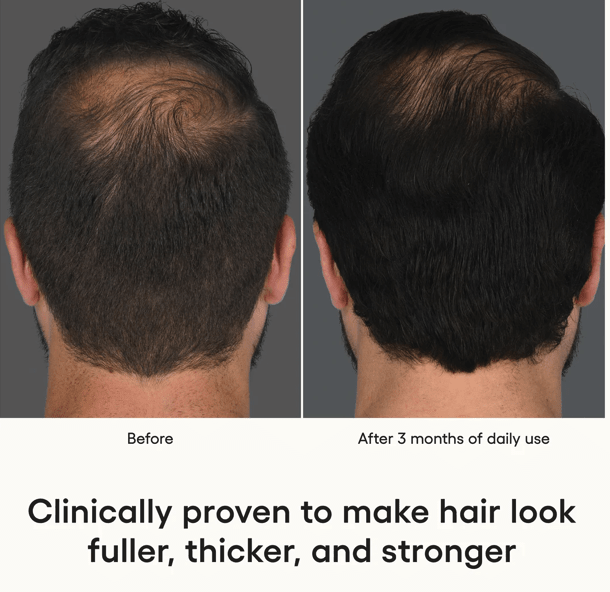 HAIR Serum - Esthetics By Cati