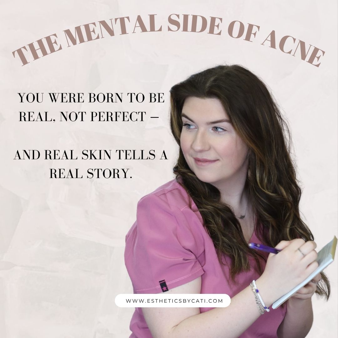 The Mental Side of Acne: Why Your Skin Story Is Also a Mind Story - Esthetics By Cati