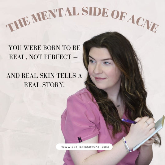 The Mental Side of Acne: Why Your Skin Story Is Also a Mind Story - Esthetics By Cati