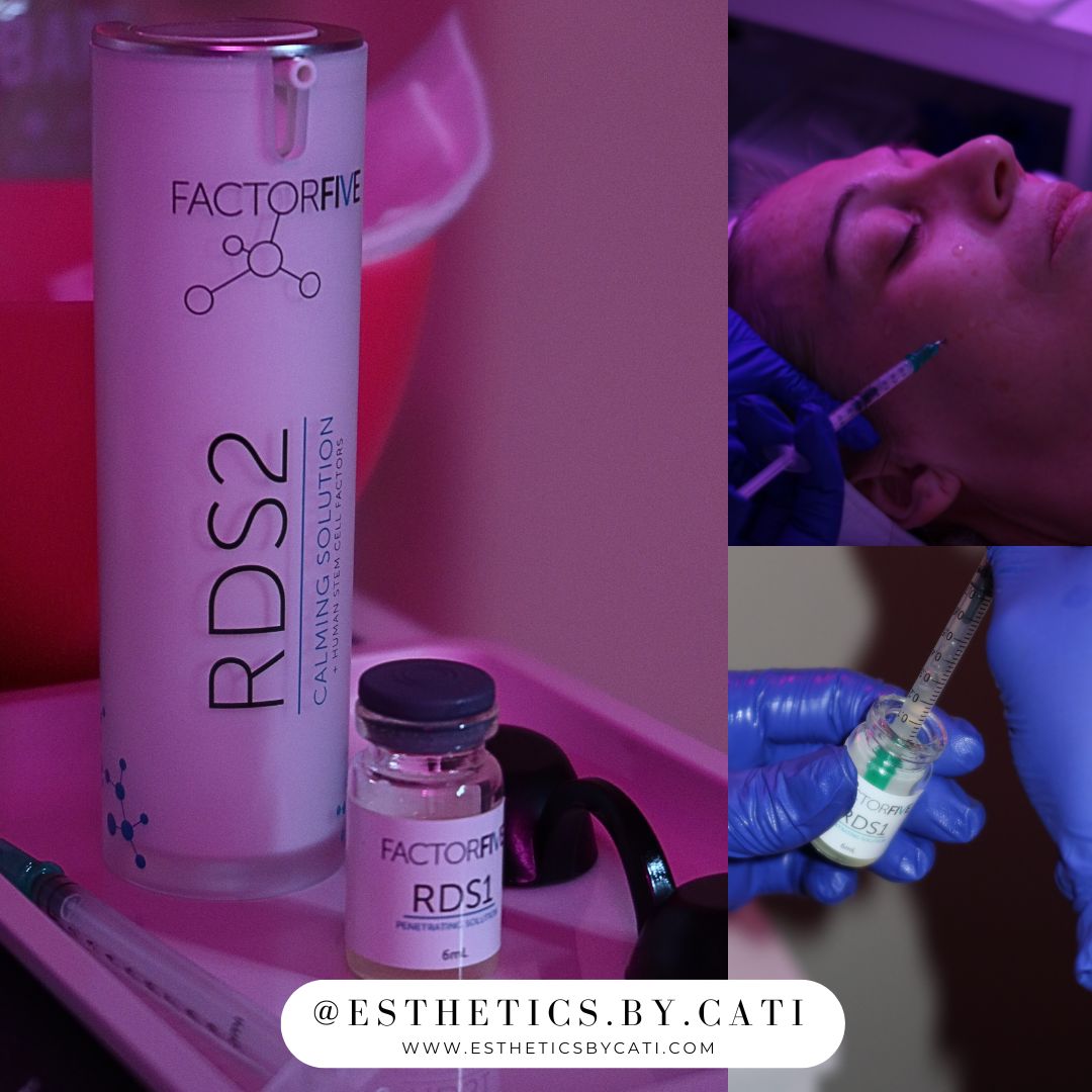 Transform Your Skin with the Glass Skin Peel: Exosome Technology at Esthetics By Cati - Esthetics By Cati