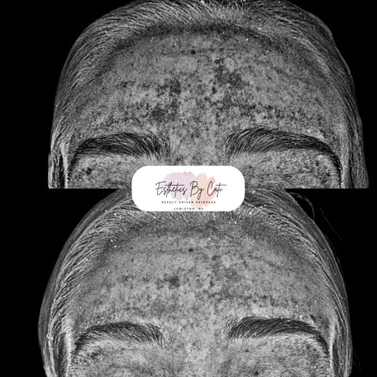 Transformations 6