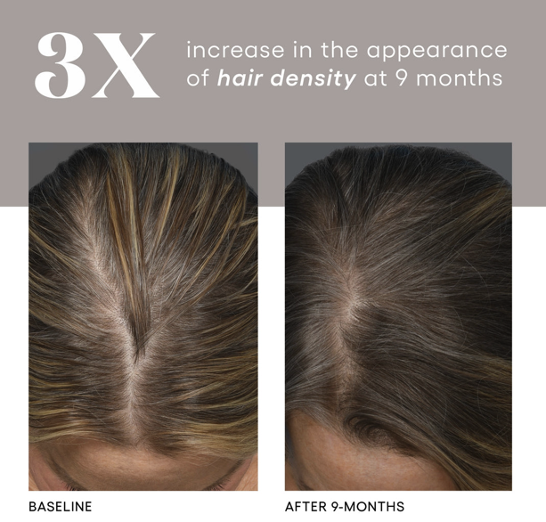 HAIR Serum