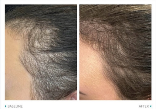 Shampoo Advanced Haircare