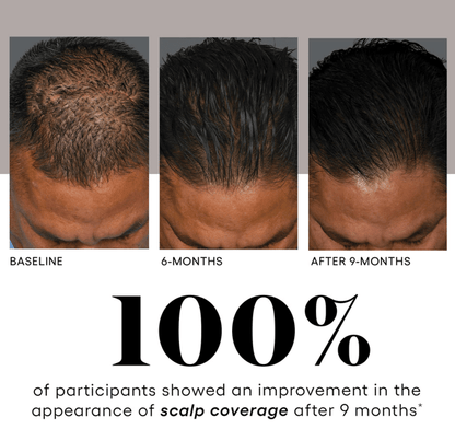 HAIR Serum - Esthetics By Cati