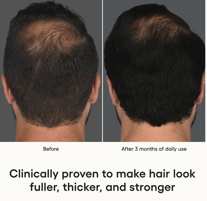 HAIR Serum - Esthetics By Cati