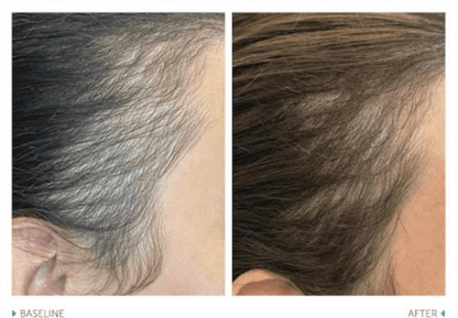 Shampoo Advanced Haircare - Esthetics By Cati