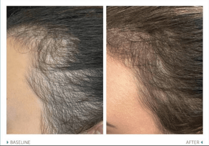 Shampoo Advanced Haircare - Esthetics By Cati